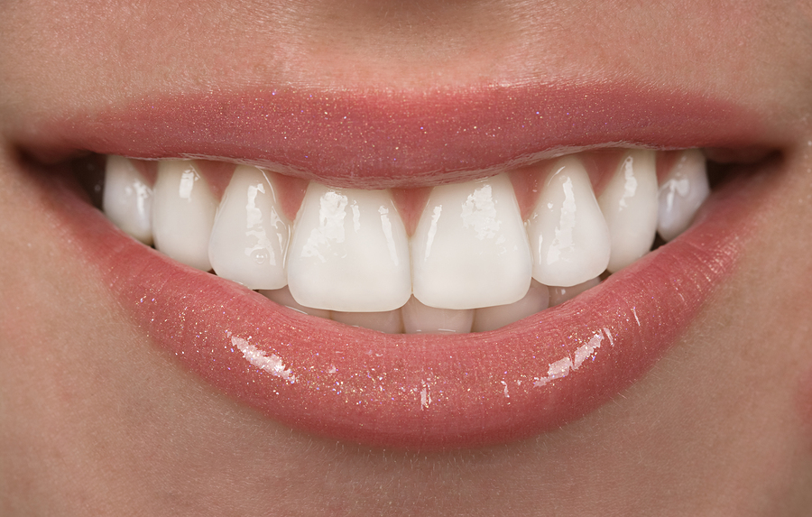 What Are The Benefits Of Laser Teeth Whitening?