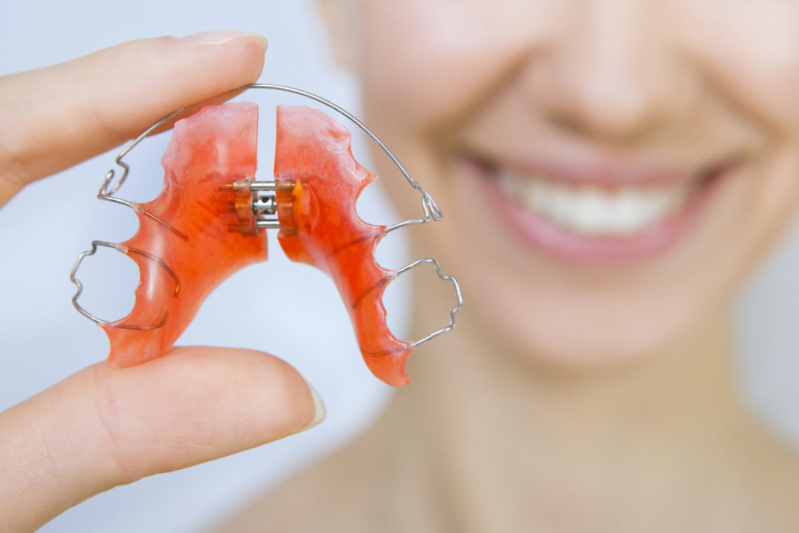 How Much Does It Cost To Repair A Broken Permanent Retainer In Houston?