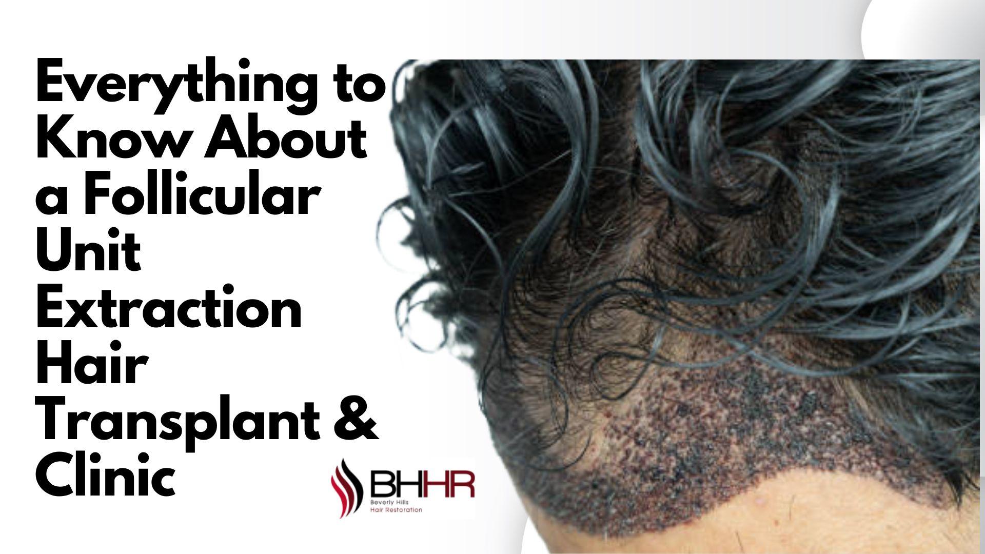 Everything to Know About a Follicular Unit Extraction Hair Transplant & Clinic
