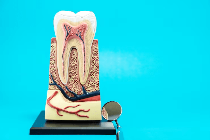 The Root Canal Procedure: Step by Step