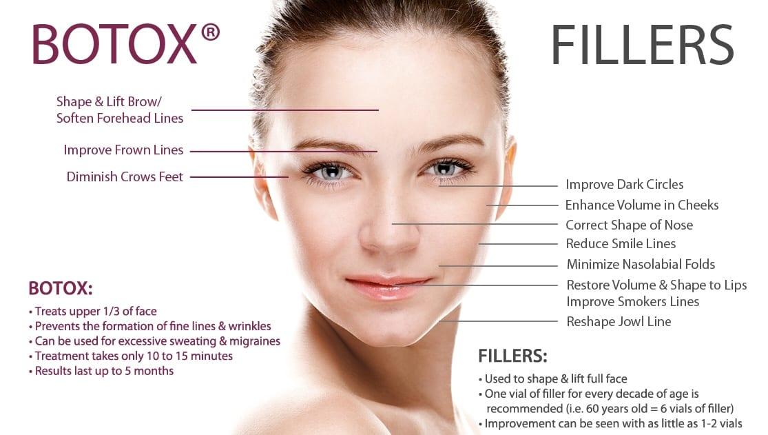 Botox vs. Dermal Fillers in Detail