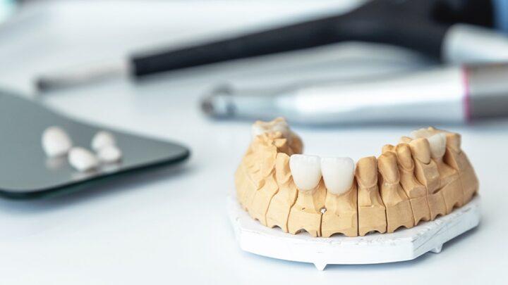 A Comprehensive Guide to Restorative Dentistry Services in Anthem