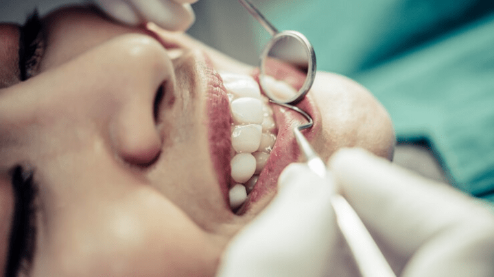 Dental Crowns: Restoring Smiles with Strength and Beauty