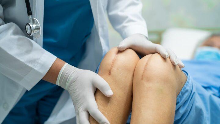Knee Transplant Surgery in Punjab – A Treatment Option for Joint Damage